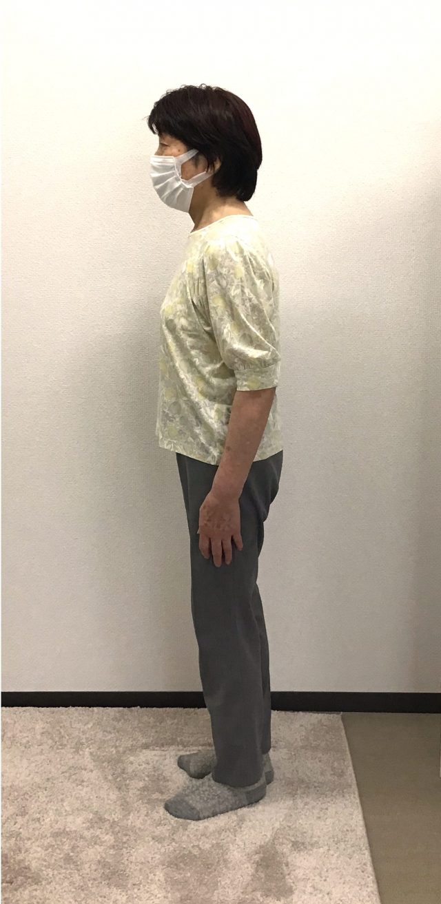 after画像
