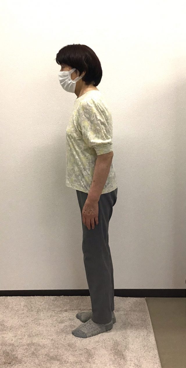 before画像