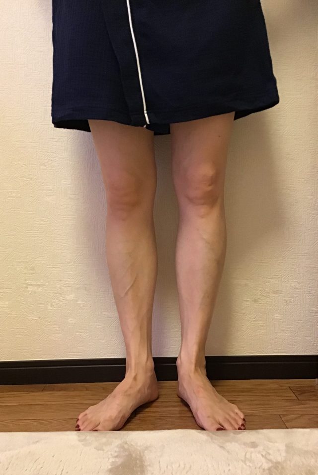 before画像
