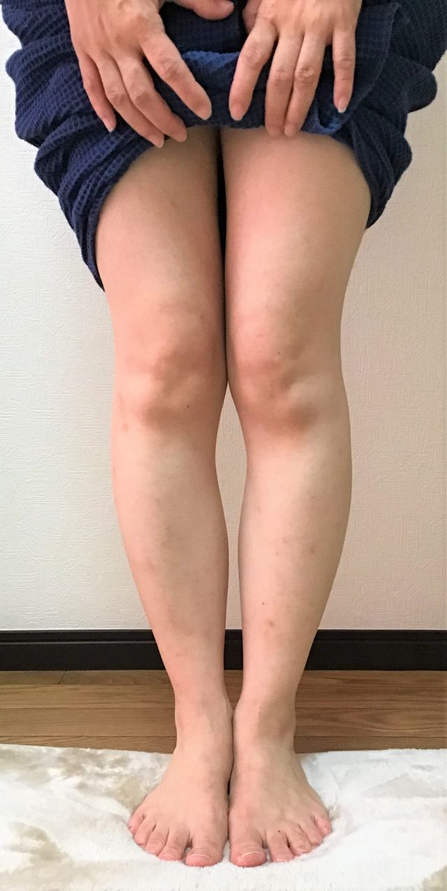 before画像