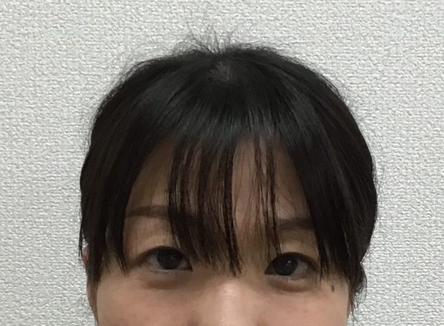 after画像