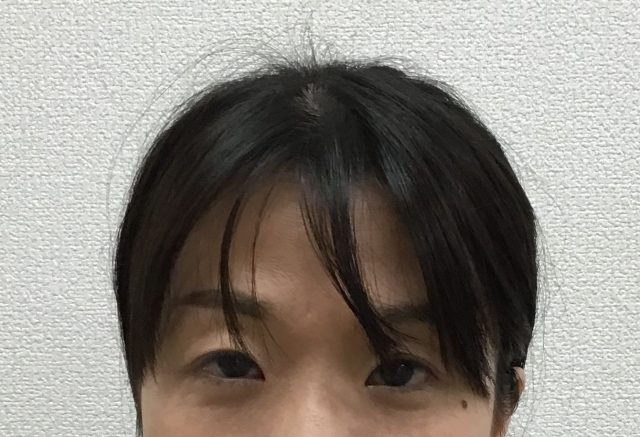 before画像