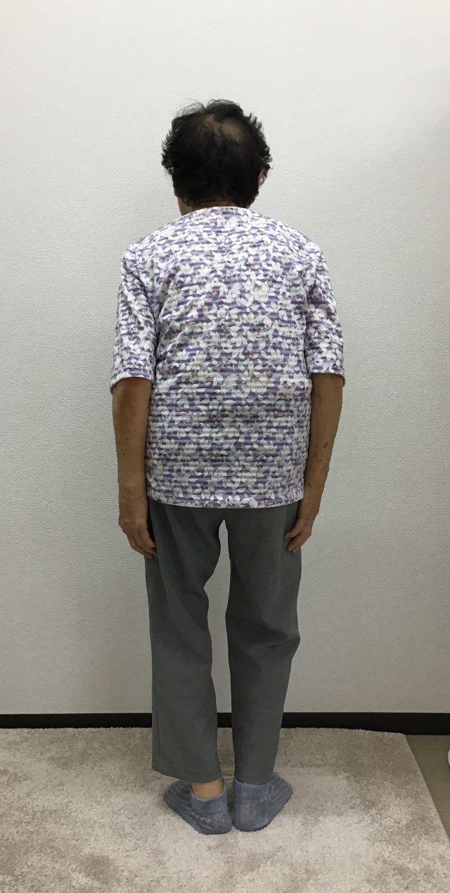 before画像