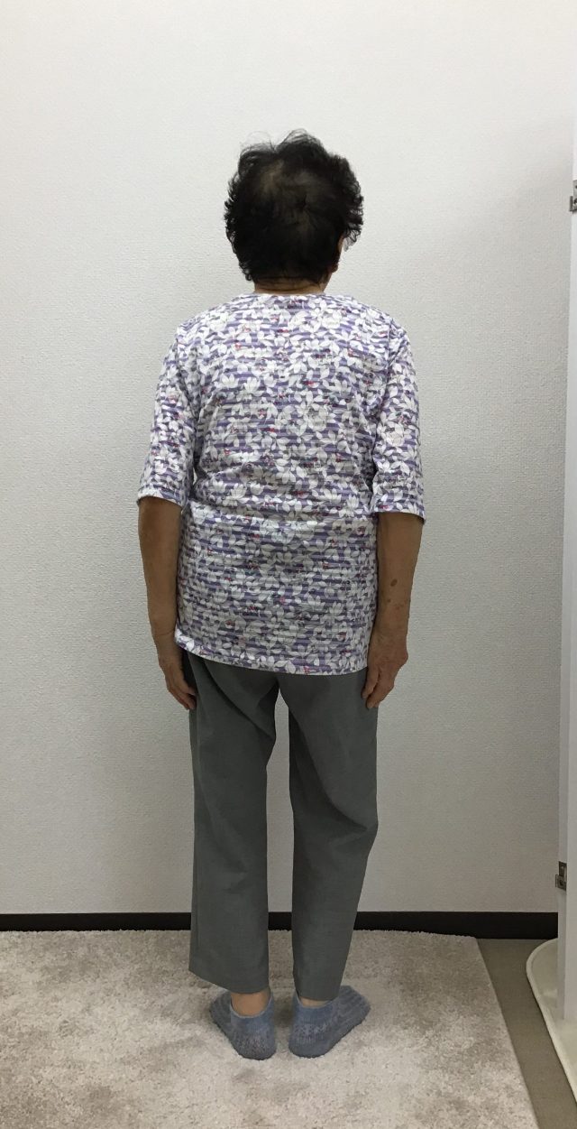 after画像