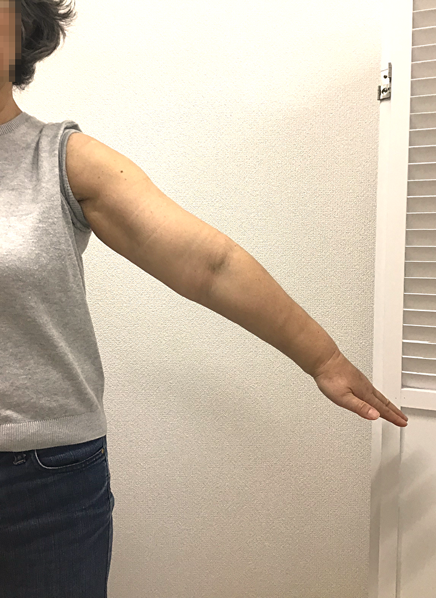 before画像
